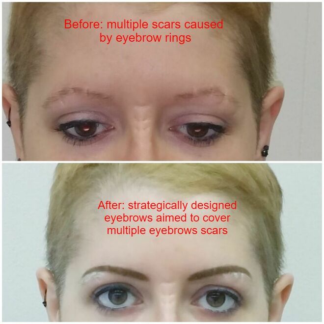 Why Do Some Eyebrow Tattoos Turn Bluish, Grayish, or Raddish?